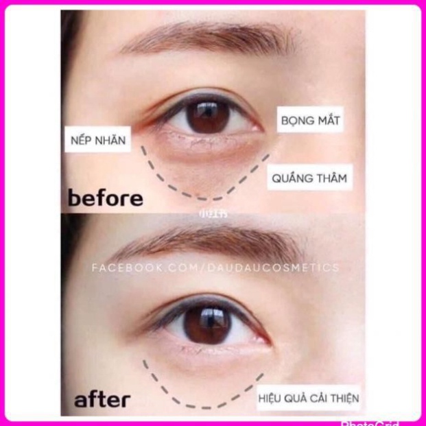 [AUTH 1000%] [MINISIZE 2.5g] Kem dưỡng mắt SKIIRNA Power Eye Cream Radical New Age 2.5g chống thâm quầng nhăn mắt