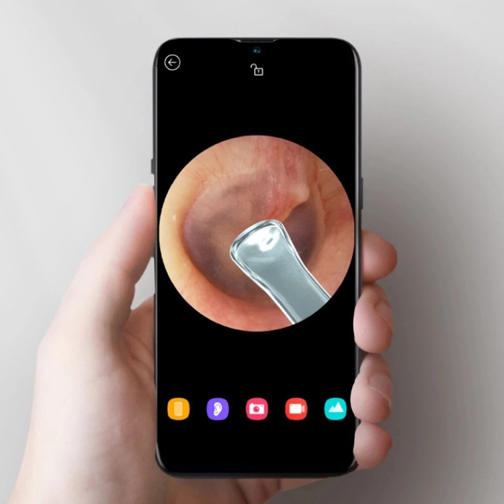 Máy Quay Nội Soi Tai Thông Minh Không Dây 300W Xiaomi Bebird R1 R3