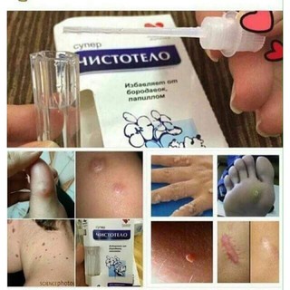 Gel Chấm Nốt Ruồi, Mụn Ruồi( Chính Hãng, Hiệu Quả, Tiết Kiệm)
