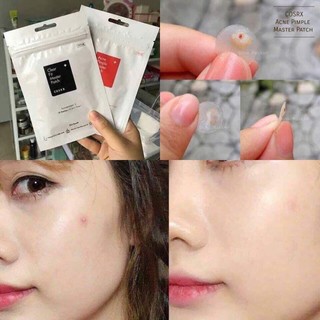 Miếng Dán Mụn Cấp Tốc Cosrx Acne Pimple Master Patch