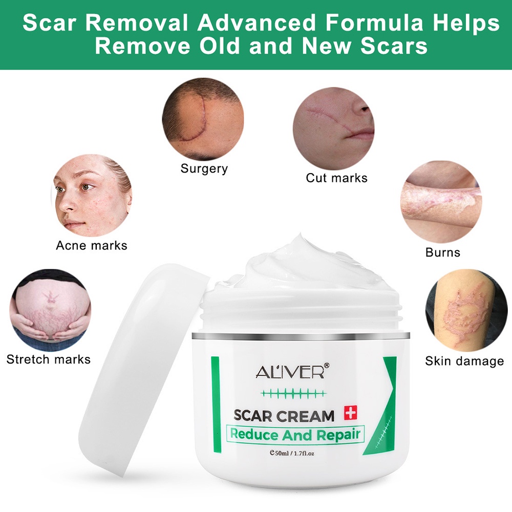 Aliver Sửa Chữa Sẹo Kem Sẹo In Làm Mịn Sửa Chữa Loại Bỏ Sẹo Kem Điều Trị Kem 50ml ALIVER Sửa Chữa Sẹo Vết Sẹo Kem đánh Dấu Loại bỏ Căng Bỏng Mổ Vết Sưng Phẫu Thuật Vết Sẹo ampere