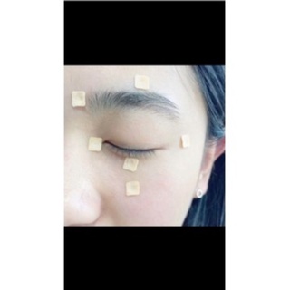 Miếng dán nhĩ châm hạt vương bất lưu hành 600 hạt