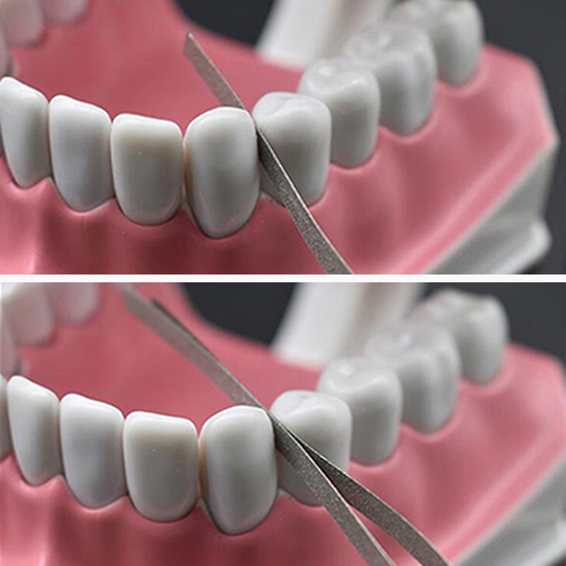 Set 12 Que Đánh Bóng Kim Loại Mạ Nhôm 4mm Chuyên Dụng Cho Nha Khoa