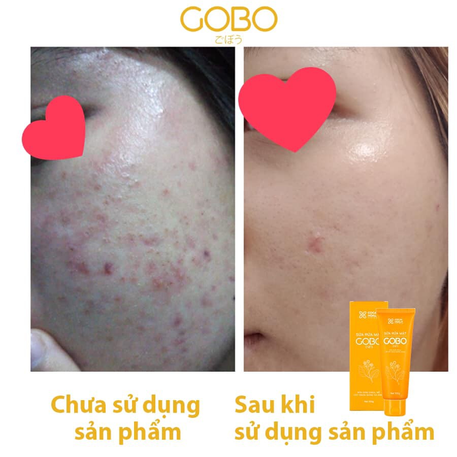 Sữa rửa mặt rễ cây ngưu bàng Gobo làm sạch sâu, ngừa mụn, mờ vết thâm Cỏ Cây Hoa Lá 100g