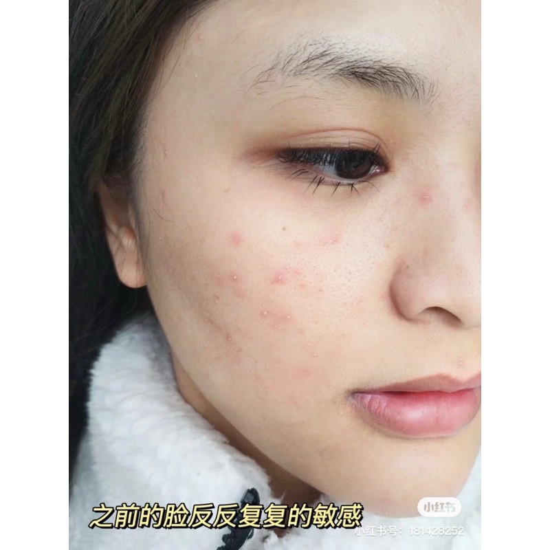 TINH CHẤT SE KHÍT LỖ CHÂN LÔNG BHA COSRX / OBG POWER LIQUID | BigBuy360 - bigbuy360.vn