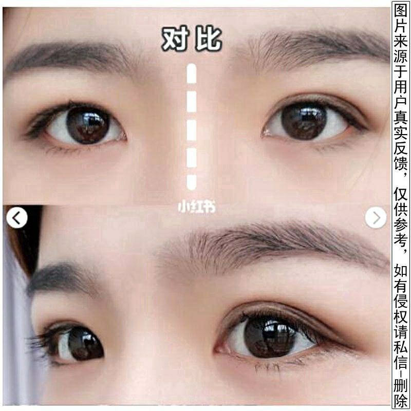 miếng dán kích mí