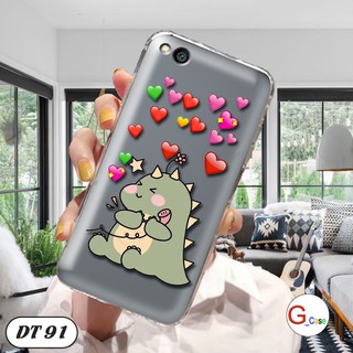 Ốp lưng dẻo Xiaomi Redmi 5A