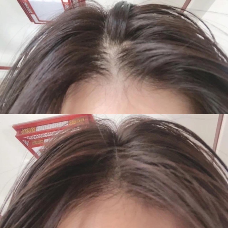 [ Tặng Bình Xịt ] Tinh Chất Kích Mọc Tóc Nhật Bản Sato | BigBuy360 - bigbuy360.vn