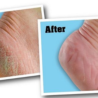 Kem nứt gót chân Heel Spa Thái Lan (50ml)