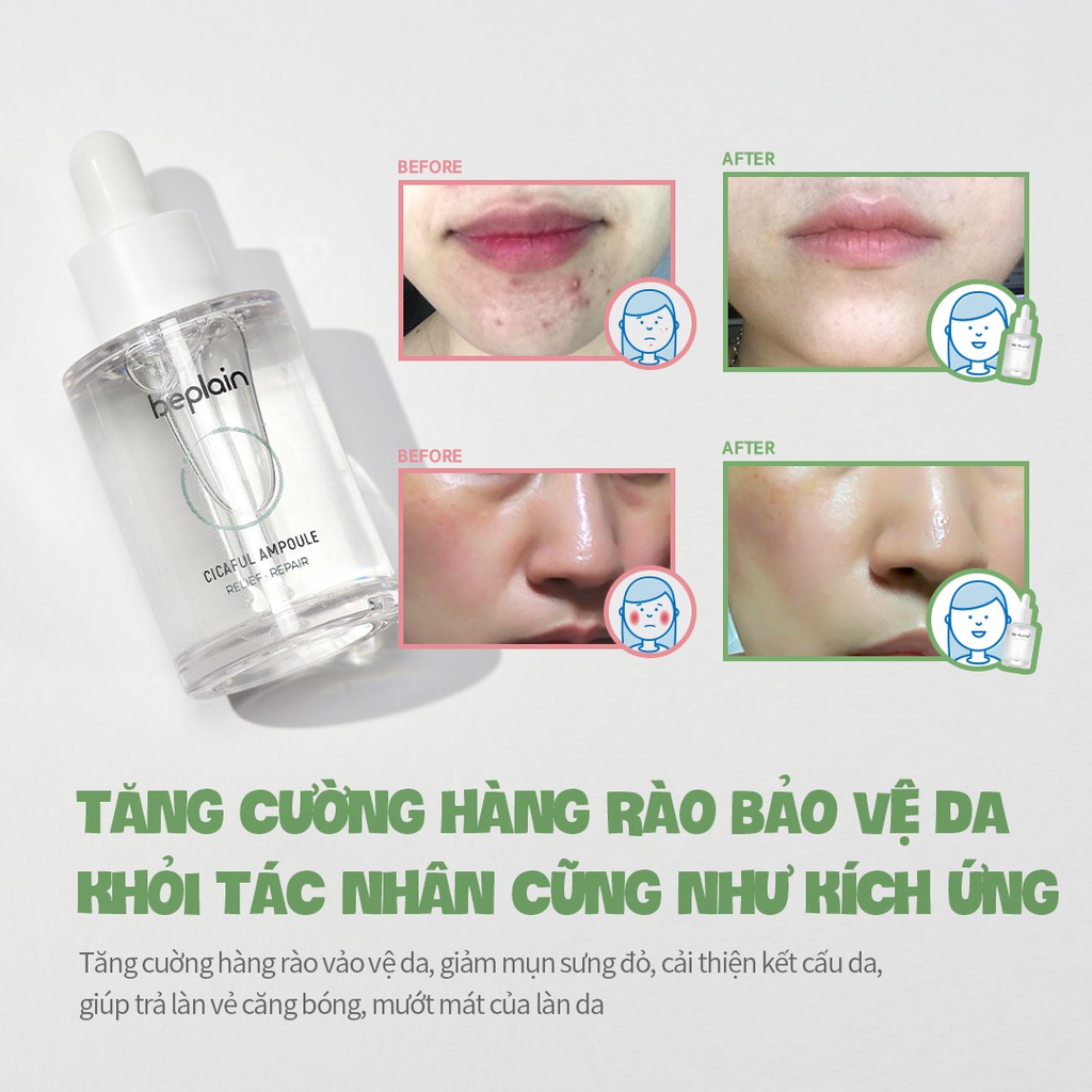 Tinh chất beplain Rau Má Cicaful thế hệ I (chứa thành phần gạo lên men) 50ml