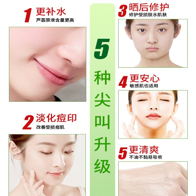 (Hàng Mới Về) Gel Trị Mụn Dưỡng Ẩm Da Chiết Xuất Lô Hội Maycreate 28g