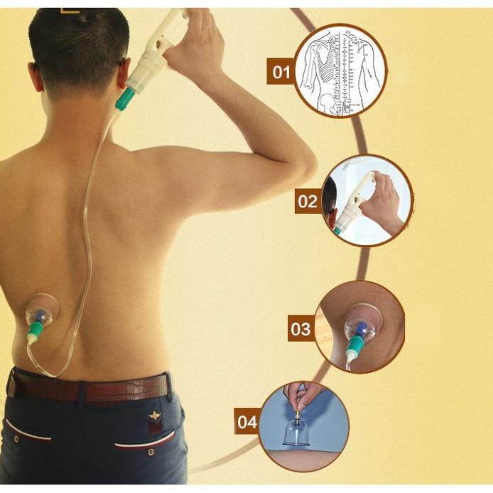 Bộ Dụng Cụ Giác Hơi Hàn Quốc ,Bộ Giác Hơi Không Dùng Lửa KAW Chính Hãng ( 24 Phụ Kiện ), Giúp Giải Độc Tố Trong Cơ Thể