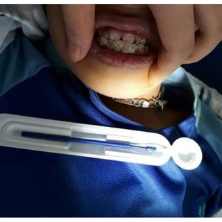 Combo 2tuyp Vecni-Fluor (loại1 màu đỏ nhập khẩu USA)