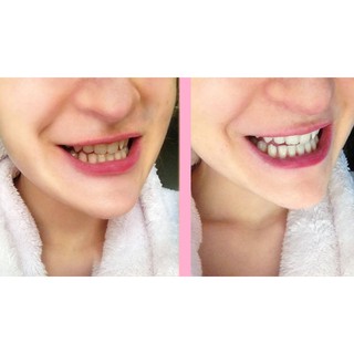  [ Full box ] 44 Miếng dán trắng răng Crest 3D Professional Effects hàng Mỹ