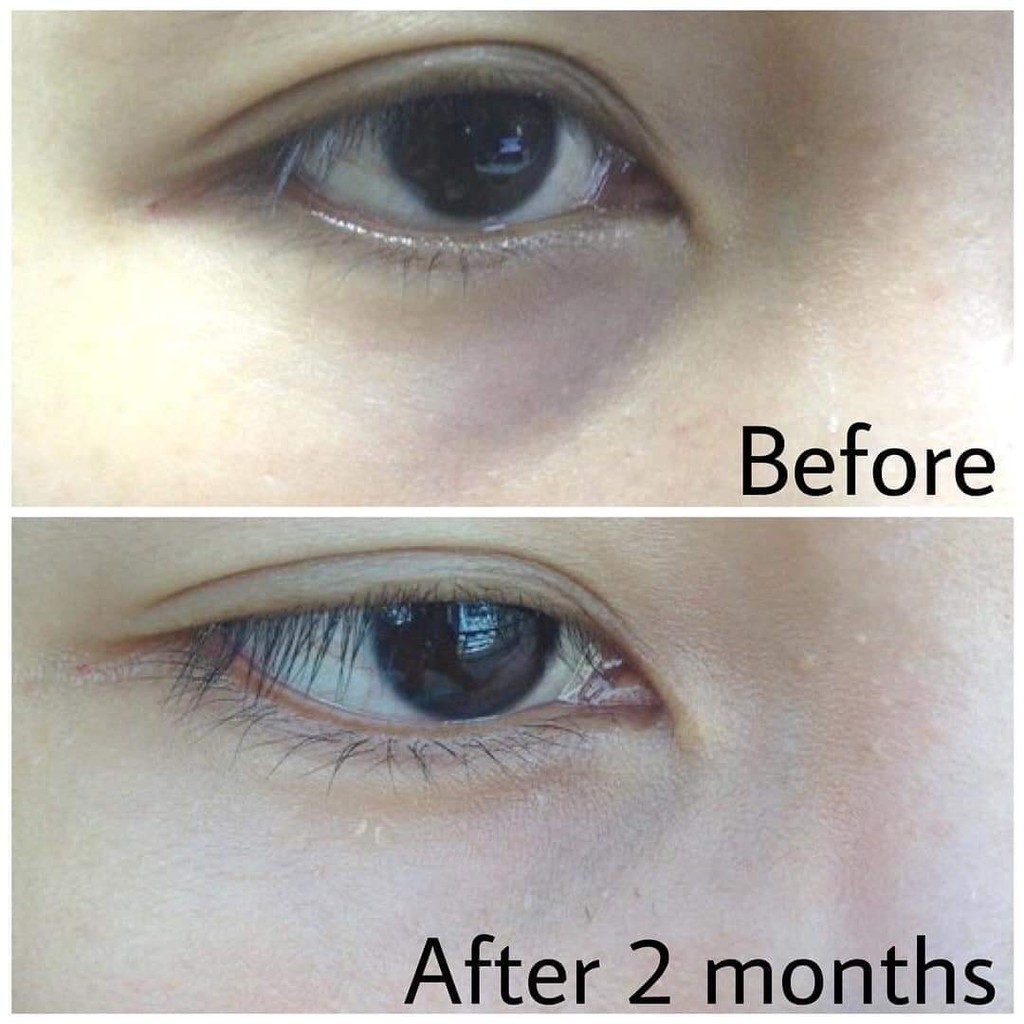 Kem mắt RoC Retinol Correxion Eye Cream 15ml bao bì mới | BigBuy360 - bigbuy360.vn