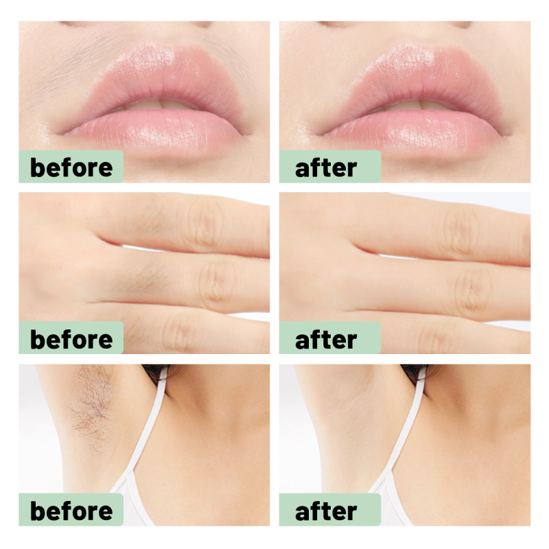 SUMAX Wax ria mép Sumax, Miếng wax tẩy lông mặt  72 Strips Small Wax Paper for Upper Lip Chin, Fingers Toes, Facial Hair Removal for Women | BigBuy360 - bigbuy360.vn