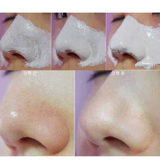 Kem lột mụn cám, mụn đầu đen 60g PEELING PACK