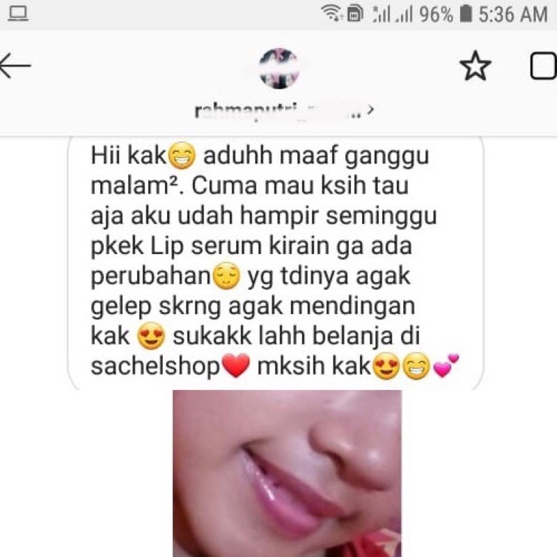 (hàng Mới Về) Serum Dưỡng Môi Chứa Vitamin Hữu Cơ Tự Nhiên Giúp Dưỡng Ẩm Và Chăm Sóc Môi | BigBuy360 - bigbuy360.vn