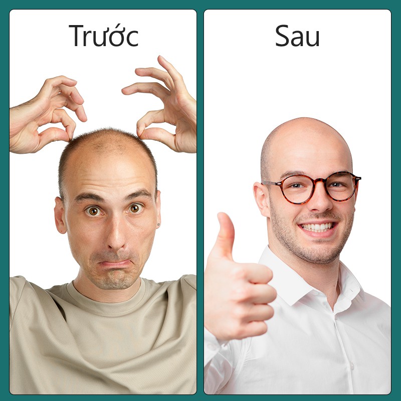 Tông đơ cắt tóc KENSEN 7D 5 trong 1 sạc USB tiện lợi