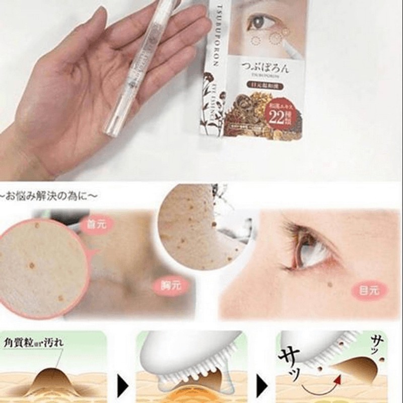 KEM NGỪA MỤN THỊT TSUBUPORON EYE ESSENCE CHO VÙNG QUANH MẮT