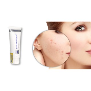 Kem xoá mờ sẹo thâm, rỗ, lõm Scar Esthetique 10ml
