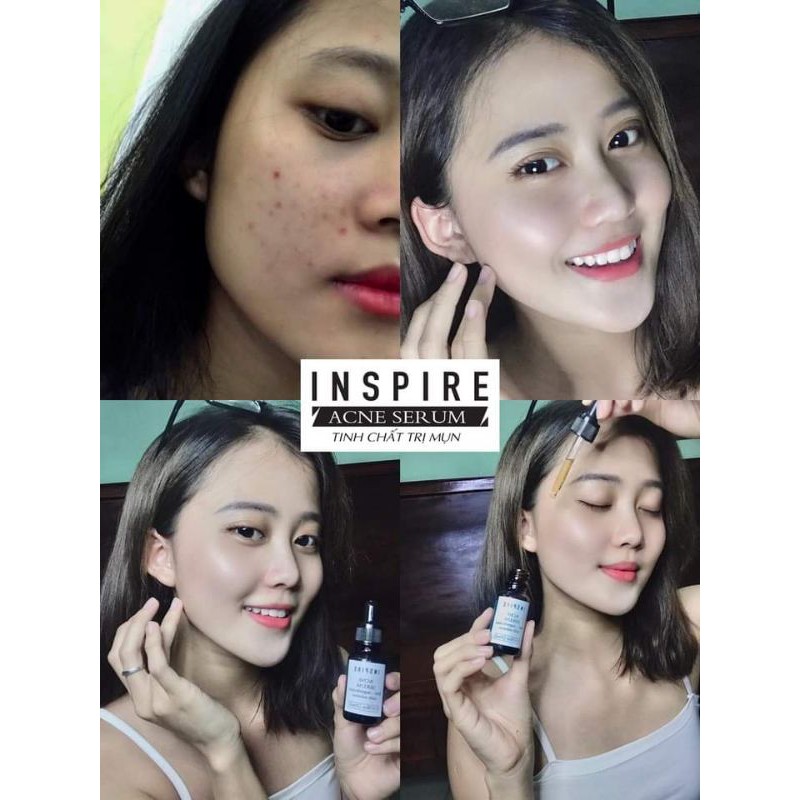 ❤FREESHIP❤SERUM TINH CHẤT CĂNG BÓNG PHỤC HỒI DA INSPIRE AMPUOLE (MUA 1 TẶNG 1)