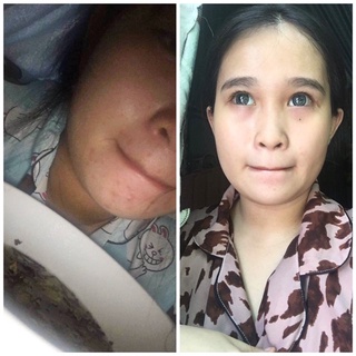 KEM FACE NHUNG P1