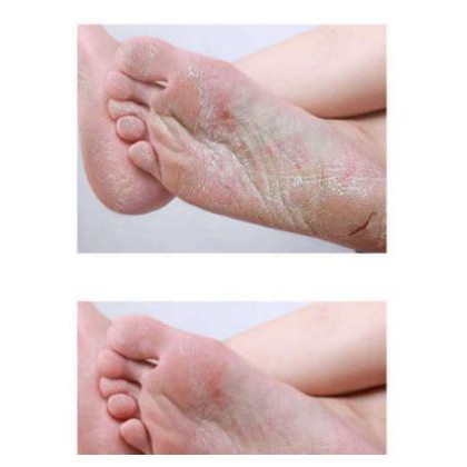 Kem dưỡng da chân tinh dầu ngựa - Giải quyết mọi vấn đề về da chân tay khô nứt nẻ | BigBuy360 - bigbuy360.vn