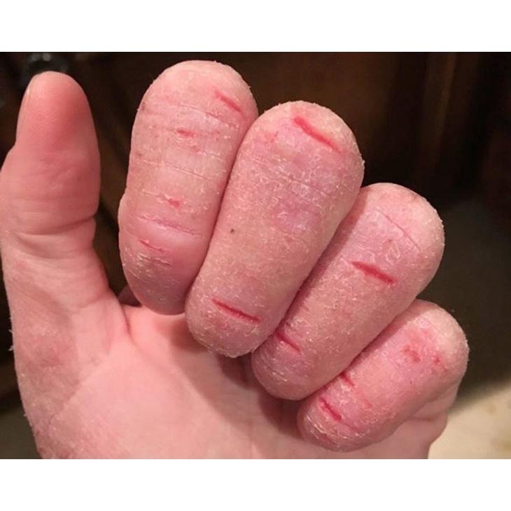 Kem Bôi Ngoài Da Ngừa Nắm Ngúa Nứt Nẻ Tay Chân(Hộp Xanh Trắng)