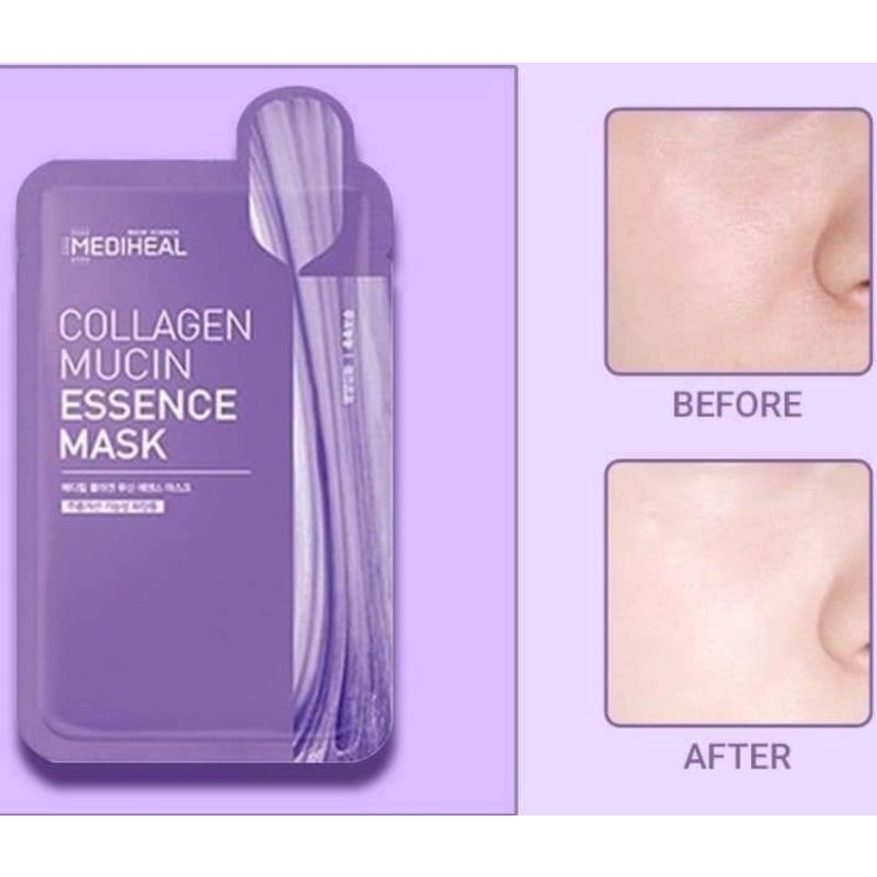 🌞 MẪU MỚI Mặt nạ MEDIHEAL 2021 🌞 | BigBuy360 - bigbuy360.vn