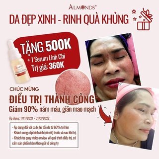 COMBO Ủ VÀ DƯỠNG TRẮNG ALMONDS