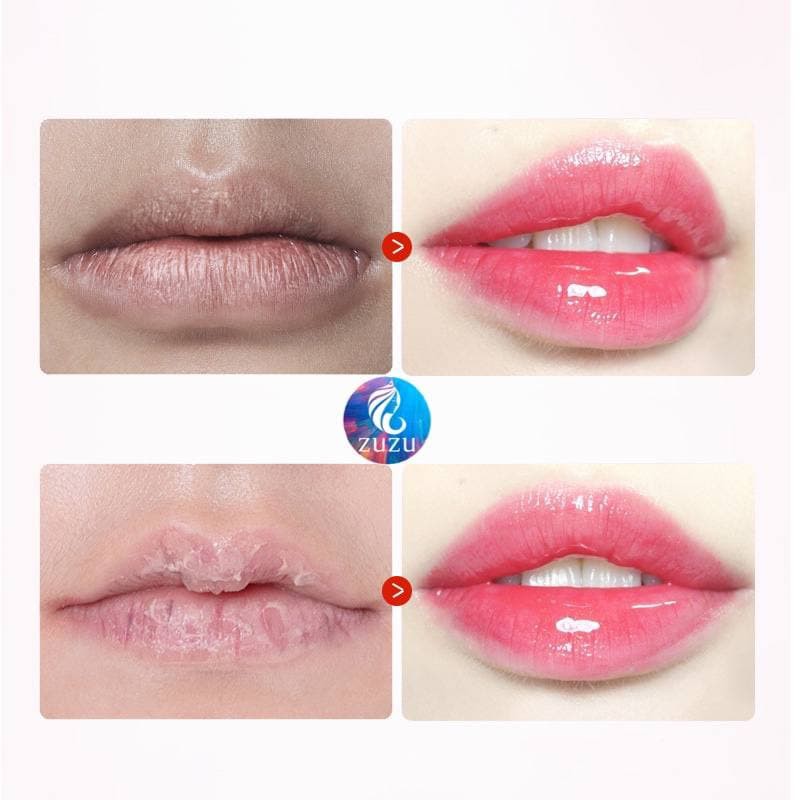 Dưỡng Môi Vaseline Lip Therapy 7g (Dạng Hũ)