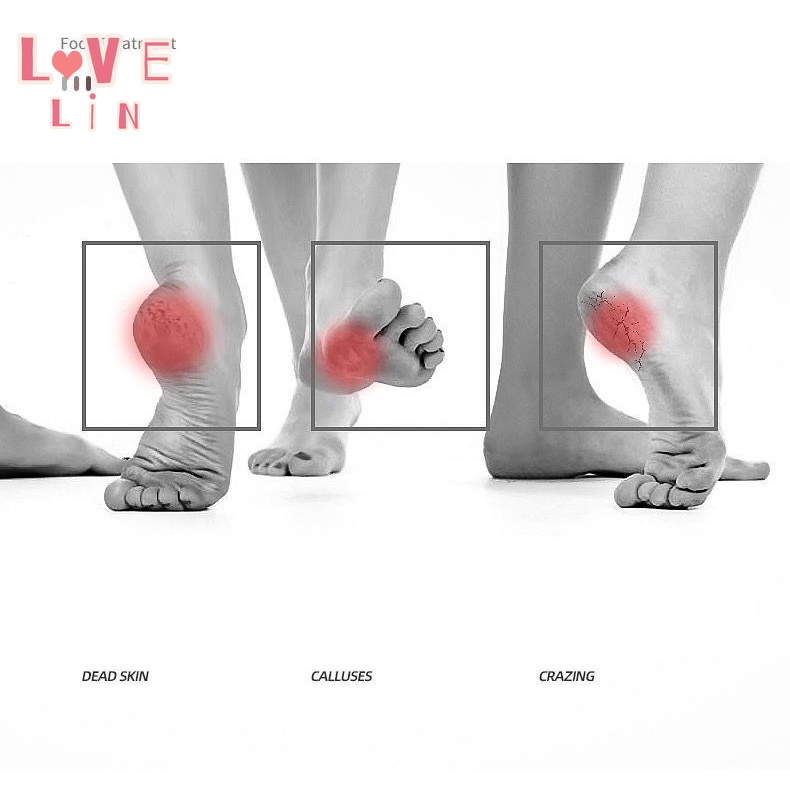 Dụng Cụ Chà Gót Chân Mát Xa Bằng Đá Thủy Tinh