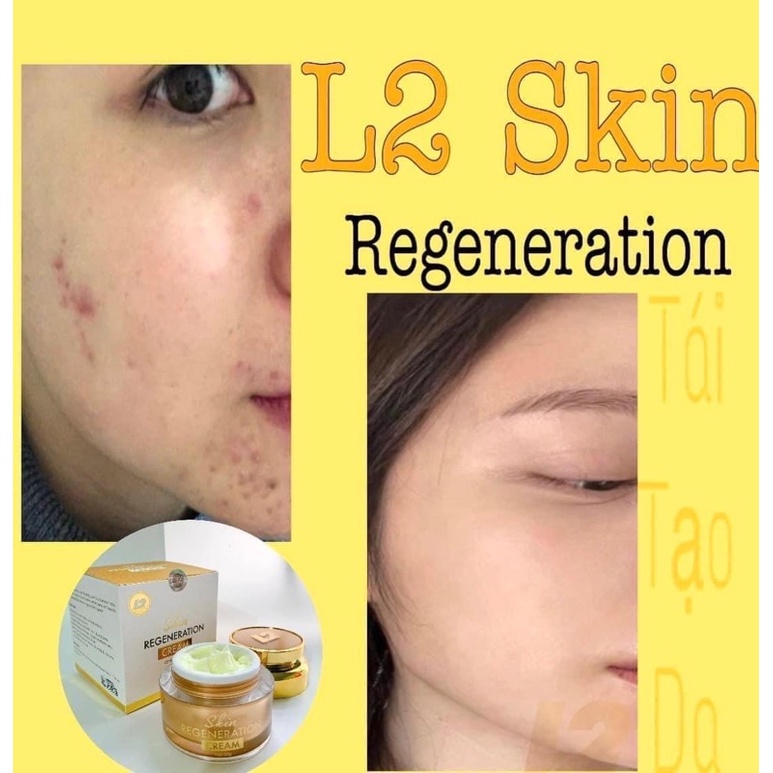 KEM TÁI TẠO DA L2 SKIN   𝐒𝐤𝐢𝐧 𝐑𝐞𝐠𝐞𝐧𝐞𝐫𝐚𝐭𝐢𝐨𝐧 𝐂𝐫𝐞𝐚𝐦 30gram