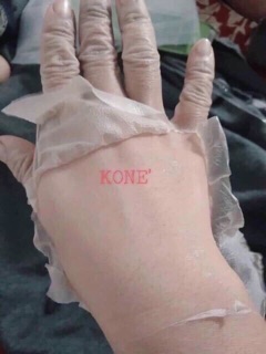 ComBo 2 chai lột da kone