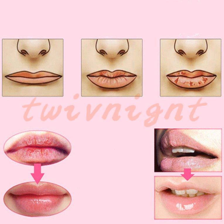 (hàng Mới Về) Mặt Nạ Môi Collagen Vàng Dưỡng Ẩm Và Phục Hồi Môi Hư Tổn | BigBuy360 - bigbuy360.vn