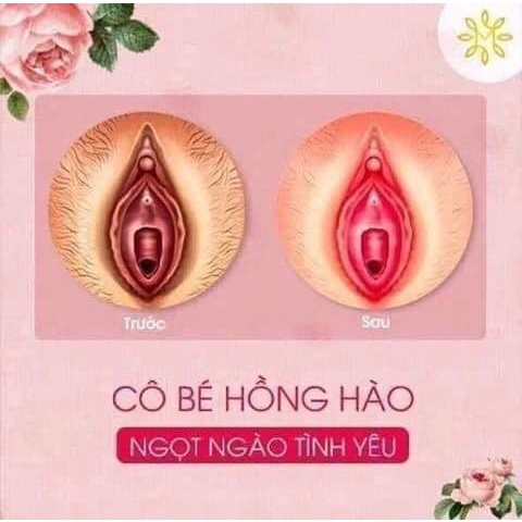 Kem Khử Thâm Làm Hồng Bi NuWhite V1 [Hàng Chính Hãng Có Tem] Khử Thâm Làm Hồng Vùng Kín Nhanh Chóng, Hiệu Quả sau 7 Ngày