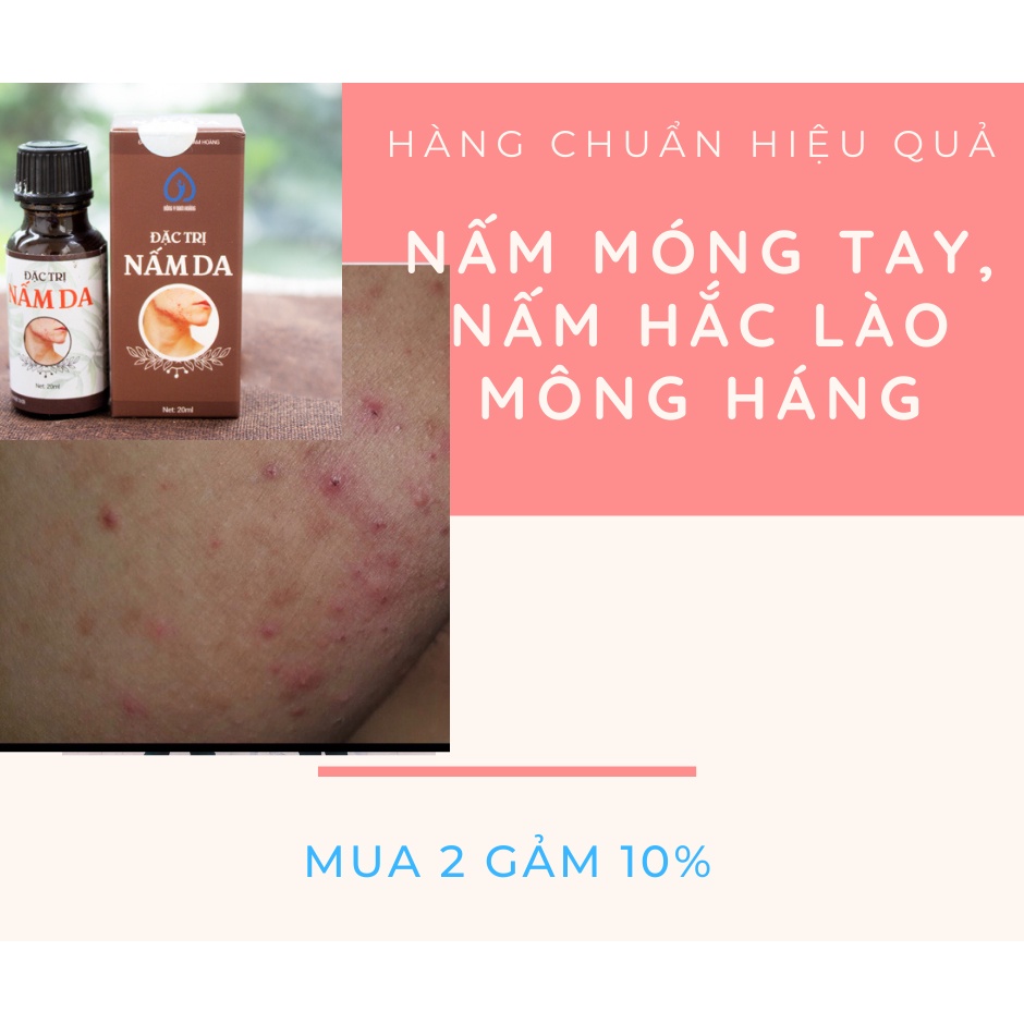 Nấm Móng Tay, Nấm Móng Chân, Hắc Lào dùng 2 lần HIỆU QUẢ  hỗ trợ cho người lâu năm , hàng chuẩn công ty