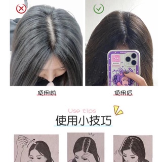  Lược Che Hói Che Khe Da Đầu