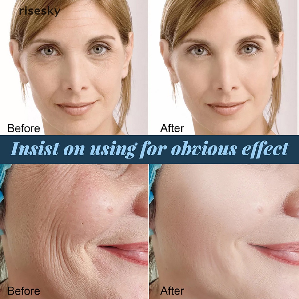 Bộ 60 Miếng Collagen Protein Nâng Cơ Mặt Chăm Sóc Da ♨Trên đó