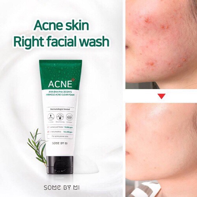 [Chính Hãng] Sữa Rửa Mặt Cho Da Mụn Some By Mi Acne AHA-BHA-PHA Clear Foam Fullsize 100ml | BigBuy360 - bigbuy360.vn