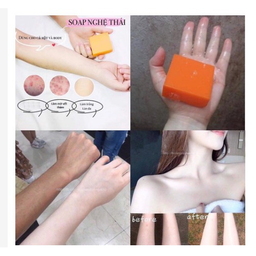 [Siêu Hot] Xà Phòng Nghệ Cam Thái Lan Trắng Da Mụn Thâm | BigBuy360 - bigbuy360.vn