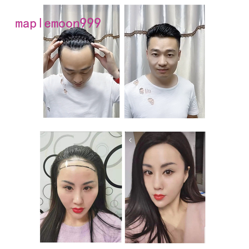 Tóc giả dạng dán vô hình tiện lợi dễ sử dụng