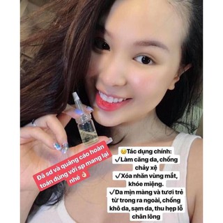 Cấy Chỉ Tơ Tằm CHITOSSIL Hàn Quốc( Hộp nguyên)