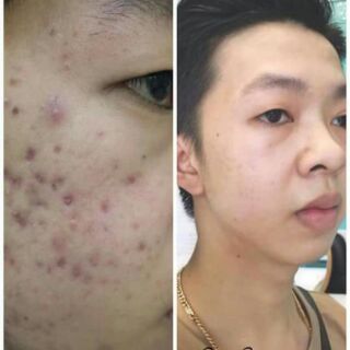 Thảo dược Mộc Linh Chi ( loại cốt )