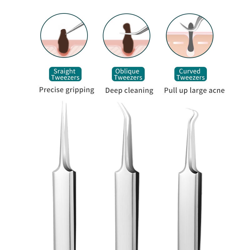 Nhíp Nặn Mụn Đầu Đen Bằng Thép Không Gỉ
