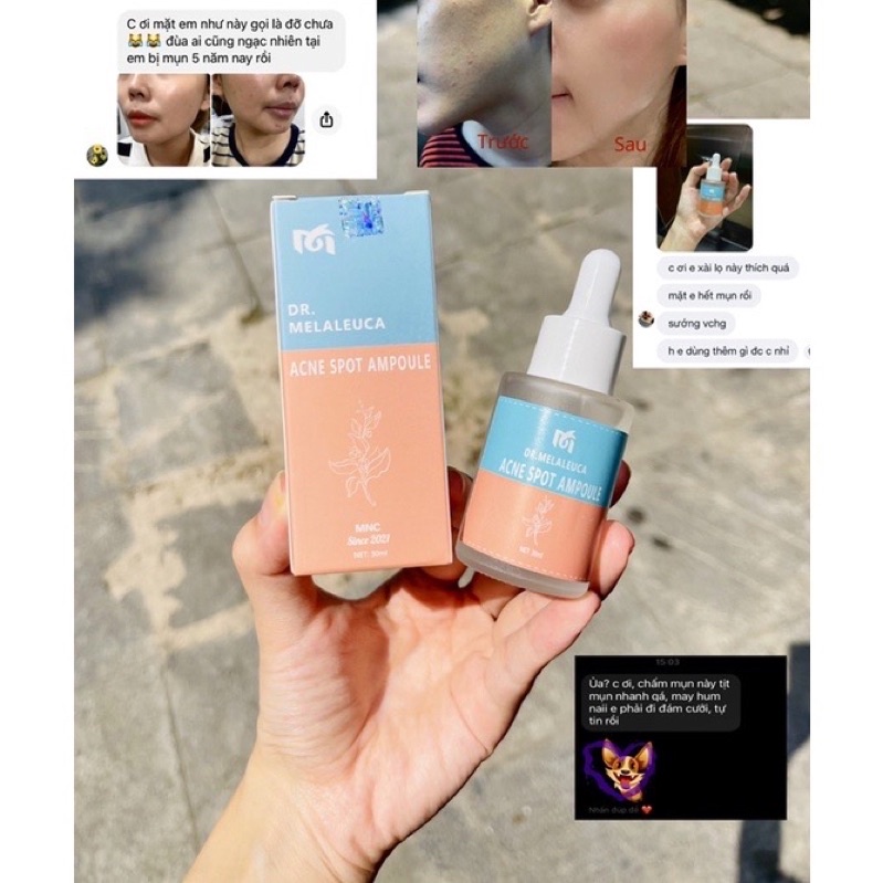 Serum mụn Acne Spot