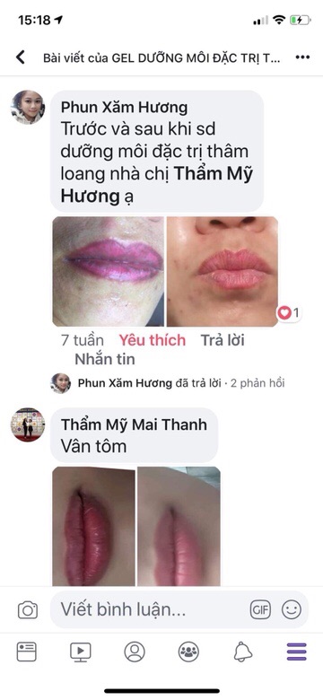 Dưỡng kích màu sau phun
