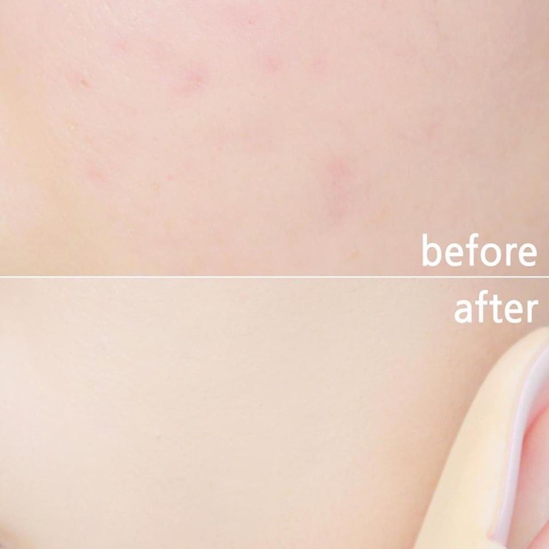 CHE KHUYẾT ĐIỂM BLACK ROUGE ZOOM IN HD COVER FIT CONCEALER | BigBuy360 - bigbuy360.vn