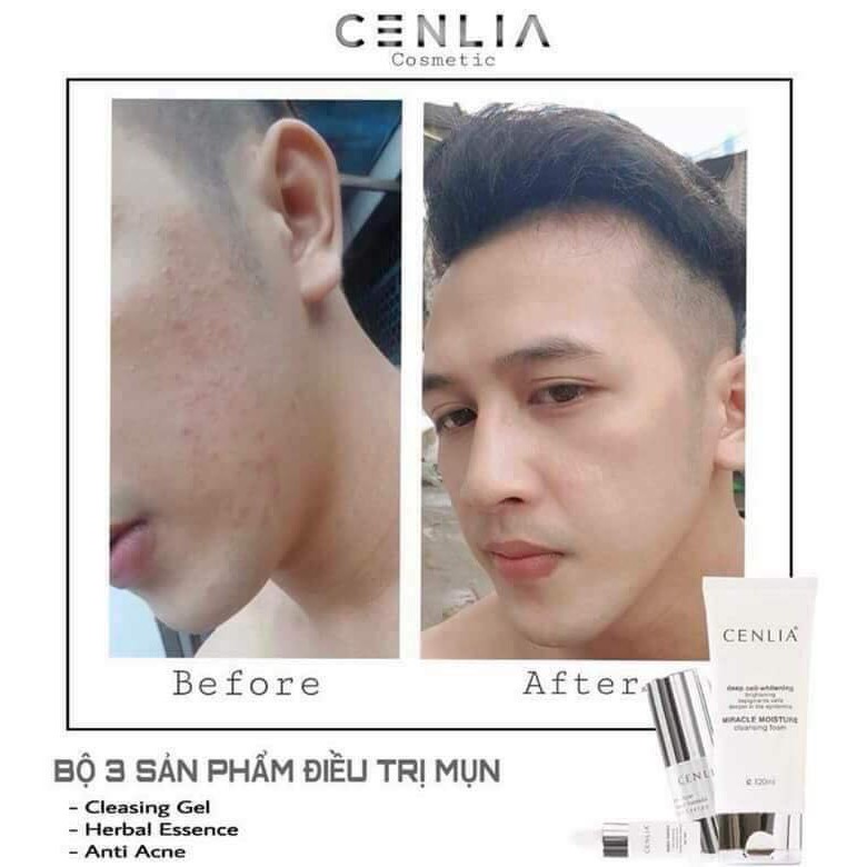 GEL MỤN CENLIA